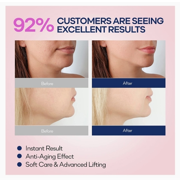 VELAMO Reusable V Line Mask Facial Slimming Strap, Double Chin Reducer, Chin Up. - Picture 4 of 10